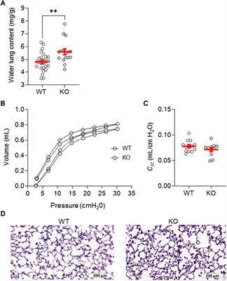 Impact of KvLQT1 potassium channel modulation on alveolar fluid homeostasis in an animal model of thiourea-induced lung edema